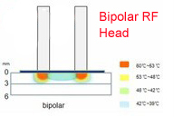 Хозяйственное оборудование красотки IPL машины Elight (IPL +RF) +Bipolar RF